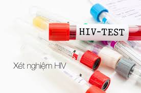 ẢNH HIV.jpg